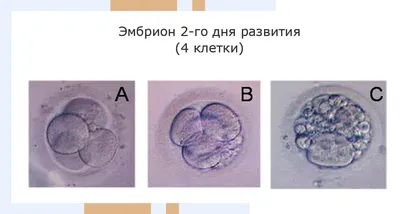 Испанские ученые смогли создать эмбрион-химеру человека и обезьяны -  АЗЕРТАДЖ