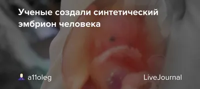 Эмбрион, 18 недель»: возможно, величайшая фотография 20-го века