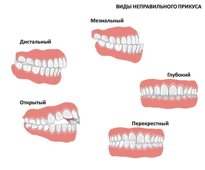 Беззубый человек ест зубы эффект …» — создано в Шедевруме