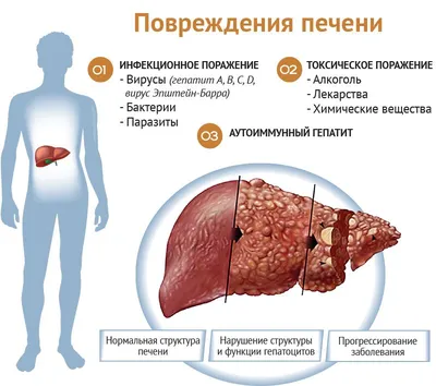 Фото больной печени человека