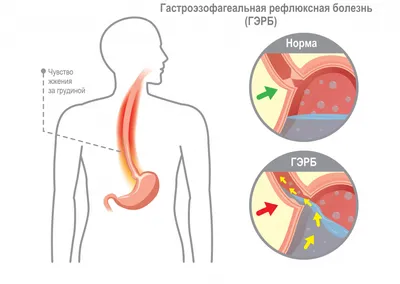 Композитная модель грудины человека | feba.ru