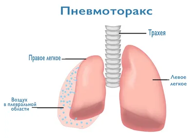 85 см скелет человека модель с нервных корешков и зеленый грудины BIX-A1004  | AliExpress