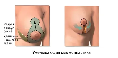 Солнце в груди человека» — создано в Шедевруме