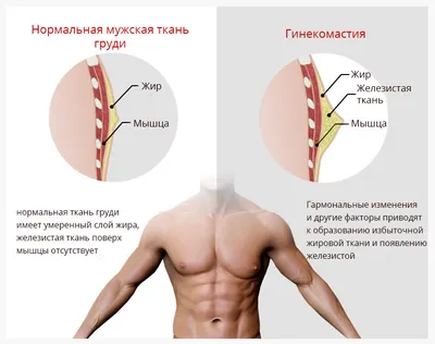 Боль в грудной клетке: причины, симптомы - Центр доктора Бубновского