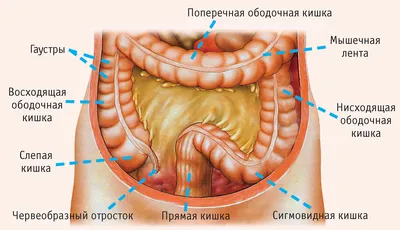 Рак прямой кишки - Рак пищеварительной системы