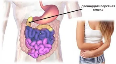 Болезни прямой кишки - диагностика и лечение