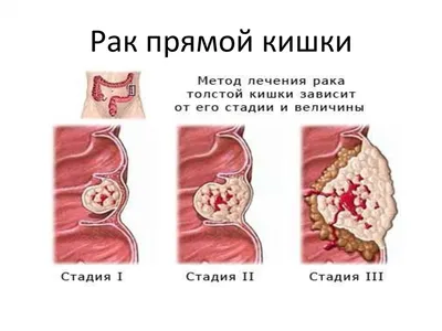 Кишечник: его влияние на Финансы и Настроение | ღ︎Мудрые Мысли за чашкой  кофеღ︎ | Дзен