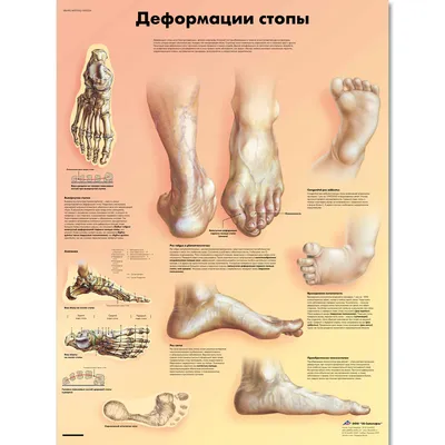 Footclinic - Особенности стопы ⠀ Стопа человека состоит из 28-30 костей,  еще большего количества суставов и множества мышц, приводящих их в  движение. ⠀ Важнейшей функцией стопы является ☝️амортизаторная, ☝️рессорная  функция, которая защищает