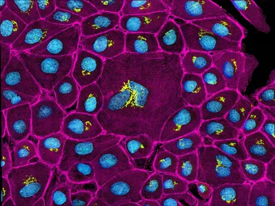 Это откроет новую вселенную»: революционный метод микроскопии впервые  позволит увидеть отдельные атомы (Nature, Великобритания) (Nature,  Великобритания) | 07.10.2022, ИноСМИ