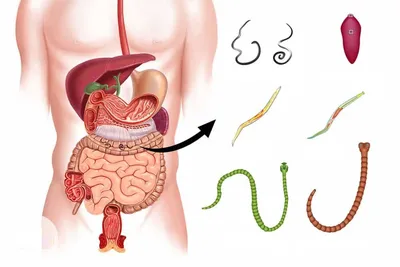 Фото паразитов живущих в организме человека