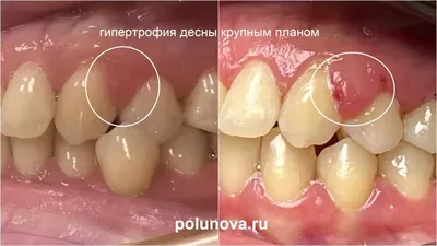 Человеческий рот Стоковые фотографии, картинки, все без лицензионных  отчислений - Envato Elements