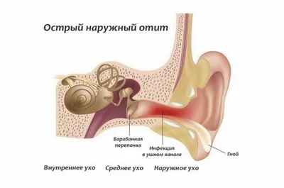 Медицинский плакат \"Акупунктура уха\" - 1002369 - VR6821L - ZVR6821L -  Плакаты по акупунктуре - 3B Scientific