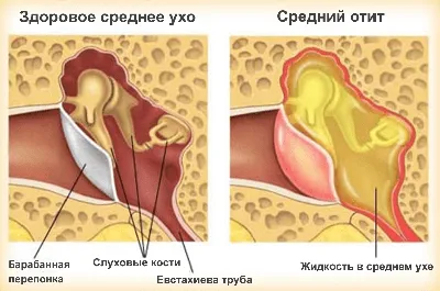 Причины и лечение головокружения | Центр Дикуля