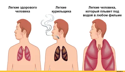 ФАКТОРЫ, ВЛИЯЮЩИЕ НА ЗДОРОВЬЕ ЧЕЛОВЕКА | Жизнь со всех ракурсов | Дзен