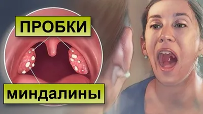 Онко Вики — Как устроена и как работает лимфатическая система?