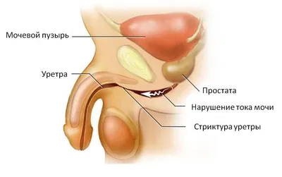 Поможет ли очищение лимфы стать здоровее?