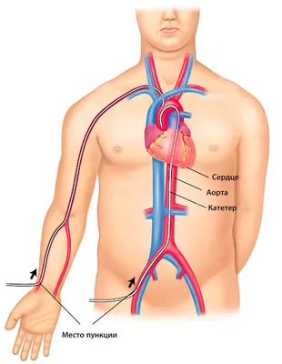 [76+] Где находится аорта у человека фото фото