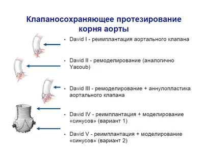 [76+] Где находится аорта у человека фото фото