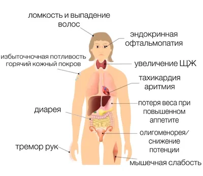 Где находится зоб у человека фото