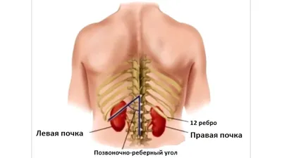 Где расположены почки у человека фото