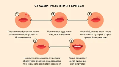 Лучшие препараты для лечения опоясывающего лишая у взрослых: список топ-5  недорогих и эффективных мазей и таблеток по версии КП с отзывами и ценами