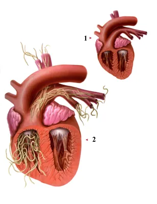 Глисты в сердце человека фото