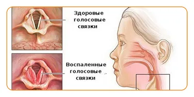 Горло Анатомия Женского — стоковые фотографии и другие картинки Подъязычная  кость - Подъязычная кость, Внутренний орган человека, Горло - iStock