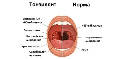 Строение гортани человека: анатомия и функции