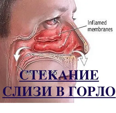 Гортань человека: что это, где находится, как выглядит и работает, почему  может болеть