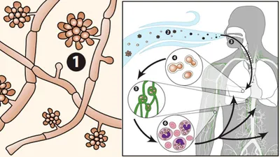 Грибы в организме человека фото фотографии