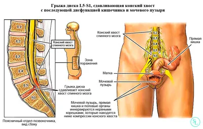 Японские ученые создали хвост для человека - Кубанские новости