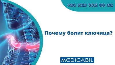 Ключица M-SKEL-CLAVICLE 105, модель 3D Иллюстрация штока - иллюстрации  насчитывающей человек, людск: 106396018