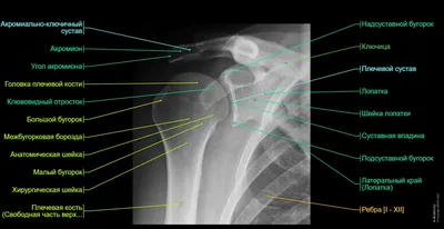 Боли в области ключицы — откуда берутся и как избавиться, болит ключица  слева или справа, причины боли при вдохе