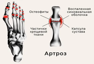 [69+] Кости ноги человека фото фото