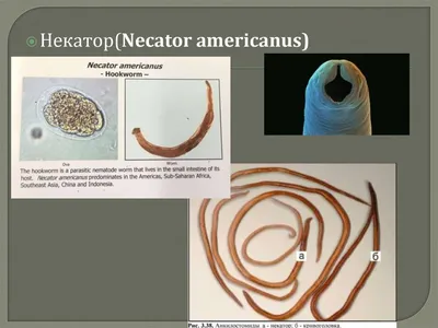 Власоглав (Trichuris trichiura). Трихоцефалёз