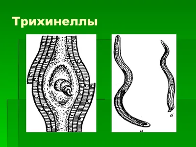 Анкилостома фото, анкилостома у человека симптомы и лечение анкилостомы  дуоденале у людей | Оптисалт