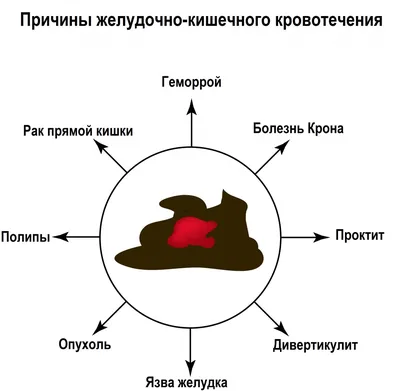 Кровь в кале фото у человека фотографии