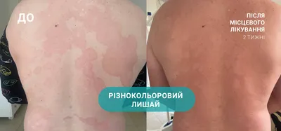 Фотографии с симптомами лишая у собак: как использовать для лечения