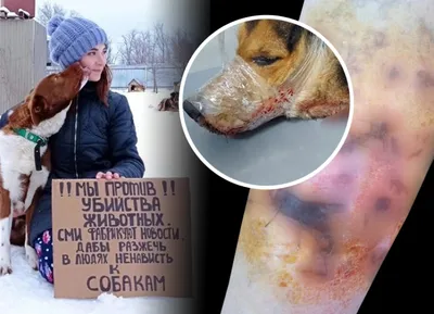 Храбрость и выживание: фото Людей после укусов собак