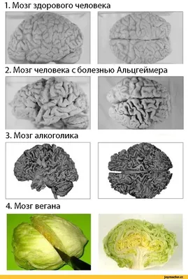 Мозг алкоголика и здорового человека фото