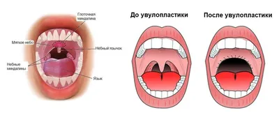 Нёбо здорового человека фото