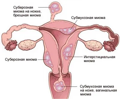 Сердце в осколках» — создано в Шедевруме