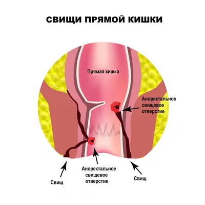 Изображения парапроктита у собак: скачать бесплатно