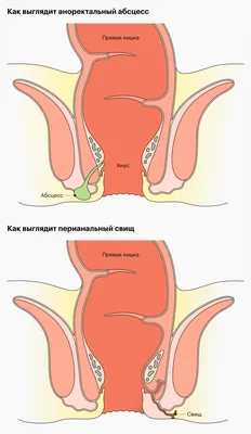 Фото парапроктита у собак: выберите размер и формат