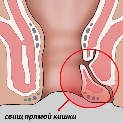 Парапроктит у собак: фото для использования в качестве обоев