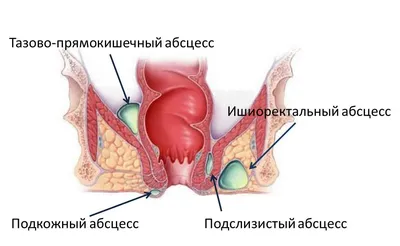 Парапроктит у собак: фото с подробным описанием