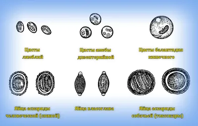 Паразиты в кале человека фото фотографии