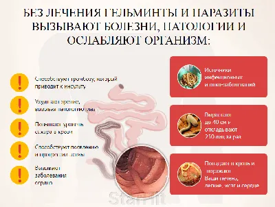 Спрятались в красной икре: Эти паразиты могут спровоцировать рак и перелом  позвоночника — годами не дают о себе знать - новости Хибины.ru / Новости за  январь 2024