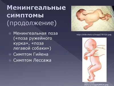 Захватывающий момент легавой собаки - скачать jpg изображение