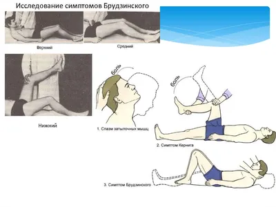 Улыбающаяся легавая собака на фото - скачать фоновую картинку